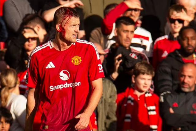 林良锋：为曼联逆转和弗爵断粮叫好？这什么世道？